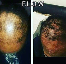 Load image into Gallery viewer, Essential Hair Growth Oil