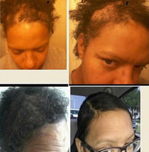 Load image into Gallery viewer, Essential Hair Growth Oil
